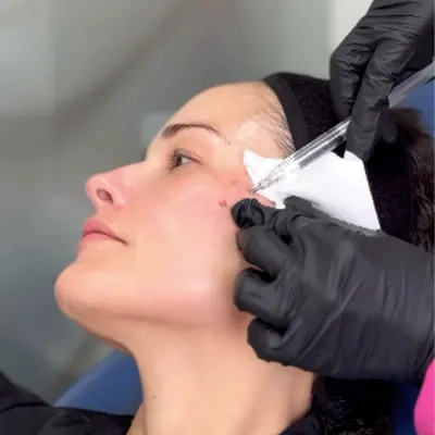 Img-Dra_Ivonne_Tole-ServicioIndividual-Tipos-Dicebord