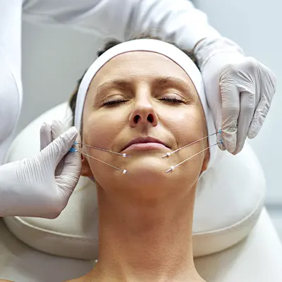 Img-Dra_Ivonne_Tole-ServicioIndividual-Tipos-Hilos de colágeno